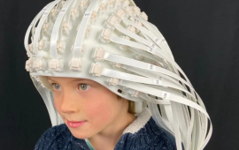 Child wears a helmet made up of more than 100 OPM sensors.